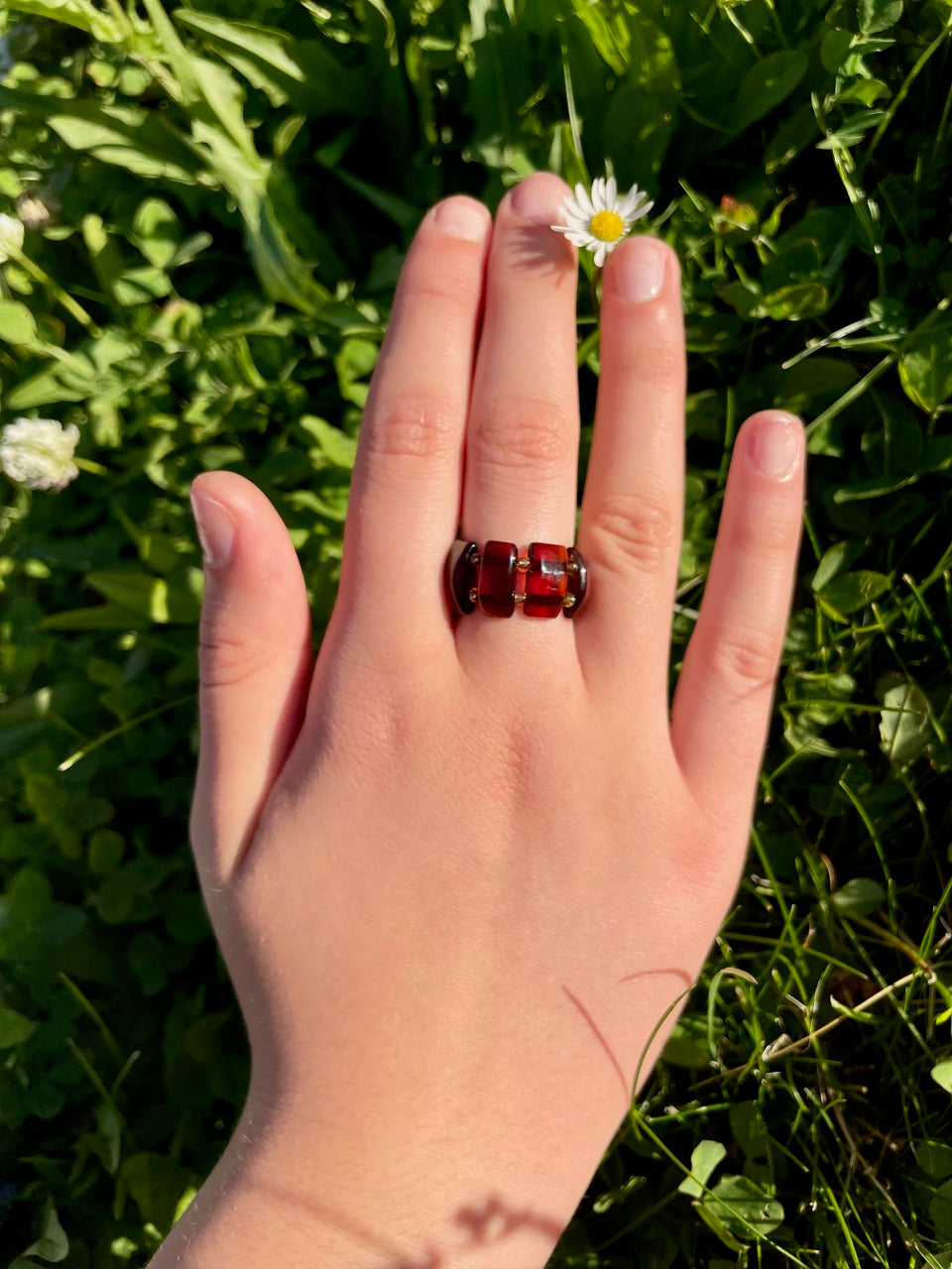 Hand mit Bernstein-Ring, Heilstein, Hautprobleme, Allergien, Neurodermitis, alternative Methoden